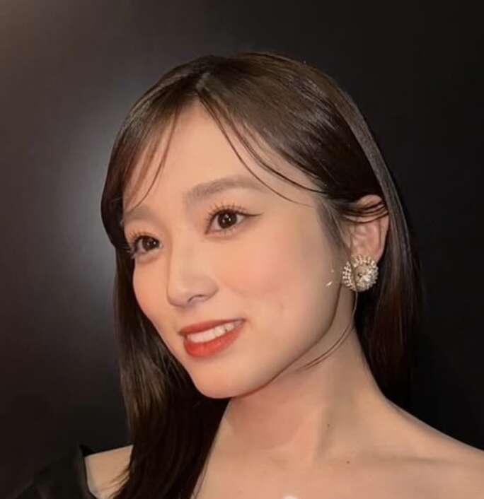 矢吹奈子 整形