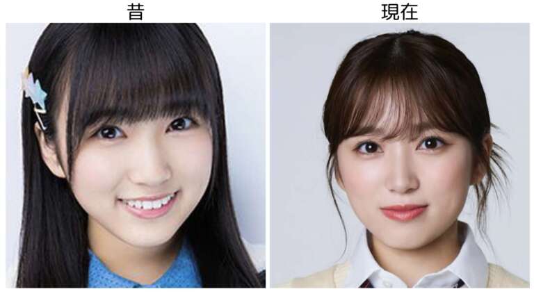 矢吹奈子 整形