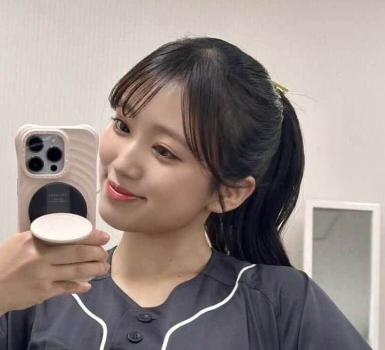 矢吹奈子 整形